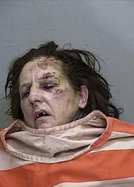 The Shocking Effects of Meth Addiction (45 pics)